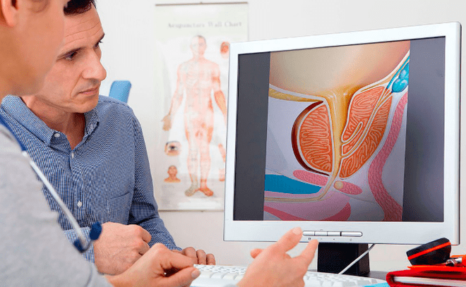 Diagnosis of prostatitis